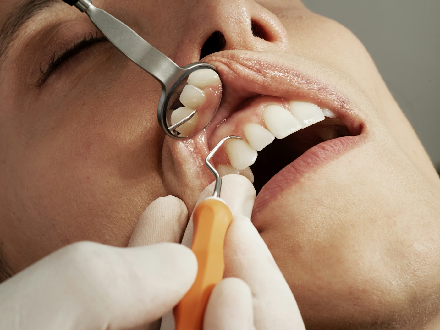 Revisión dental con un espejo de exploración